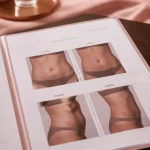 Diastasis avant apres : ventre, cicatrice et nombril (photos)